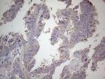 SDHB Antibody in Immunohistochemistry (Paraffin) (IHC (P))