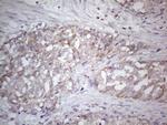 SDHB Antibody in Immunohistochemistry (Paraffin) (IHC (P))