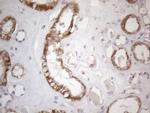 SDHB Antibody in Immunohistochemistry (Paraffin) (IHC (P))