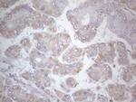 SDHB Antibody in Immunohistochemistry (Paraffin) (IHC (P))