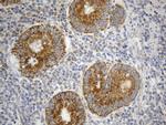 SDHB Antibody in Immunohistochemistry (Paraffin) (IHC (P))