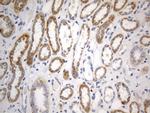 SDHB Antibody in Immunohistochemistry (Paraffin) (IHC (P))