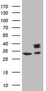 SDHB Antibody in Western Blot (WB)