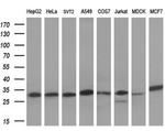 SDHB Antibody in Western Blot (WB)