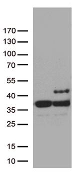 SDHB Antibody in Western Blot (WB)