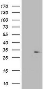 SDR9C7 Antibody in Western Blot (WB)