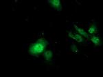 SDS Antibody in Immunocytochemistry (ICC/IF)