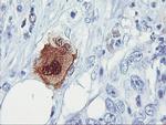 SDS Antibody in Immunohistochemistry (Paraffin) (IHC (P))