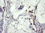 SDS Antibody in Immunohistochemistry (Paraffin) (IHC (P))