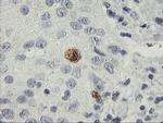 SDS Antibody in Immunohistochemistry (Paraffin) (IHC (P))