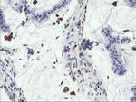 SDS Antibody in Immunohistochemistry (Paraffin) (IHC (P))