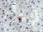 SDS Antibody in Immunohistochemistry (Paraffin) (IHC (P))