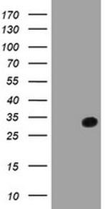 SDS Antibody in Western Blot (WB)