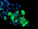 SENP2 Antibody in Immunocytochemistry (ICC/IF)