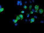 SENP2 Antibody in Immunocytochemistry (ICC/IF)