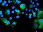 SENP2 Antibody in Immunocytochemistry (ICC/IF)