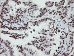 SENP2 Antibody in Immunohistochemistry (Paraffin) (IHC (P))