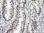 SENP2 Antibody in Immunohistochemistry (Paraffin) (IHC (P))