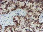 SENP2 Antibody in Immunohistochemistry (Paraffin) (IHC (P))