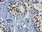 SENP2 Antibody in Immunohistochemistry (Paraffin) (IHC (P))