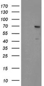 SENP2 Antibody in Western Blot (WB)