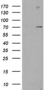 SENP2 Antibody in Western Blot (WB)