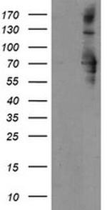 SENP2 Antibody in Western Blot (WB)