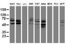 SENP2 Antibody in Western Blot (WB)