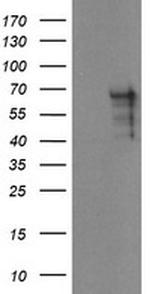 SENP2 Antibody in Western Blot (WB)