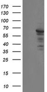 SENP2 Antibody in Western Blot (WB)