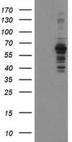 SENP2 Antibody in Western Blot (WB)