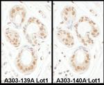 SENP3 Antibody in Immunohistochemistry (IHC)