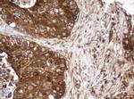 SERBP1 Antibody in Immunohistochemistry (Paraffin) (IHC (P))