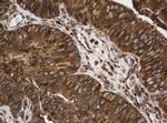 SERBP1 Antibody in Immunohistochemistry (Paraffin) (IHC (P))