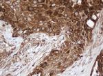 SERBP1 Antibody in Immunohistochemistry (Paraffin) (IHC (P))