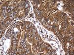 SERBP1 Antibody in Immunohistochemistry (Paraffin) (IHC (P))