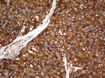 SERBP1 Antibody in Immunohistochemistry (Paraffin) (IHC (P))