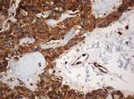 SERBP1 Antibody in Immunohistochemistry (Paraffin) (IHC (P))