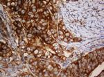 SERBP1 Antibody in Immunohistochemistry (Paraffin) (IHC (P))