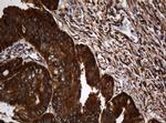 SERBP1 Antibody in Immunohistochemistry (Paraffin) (IHC (P))