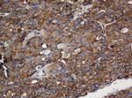 SERBP1 Antibody in Immunohistochemistry (Paraffin) (IHC (P))