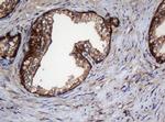 SERBP1 Antibody in Immunohistochemistry (Paraffin) (IHC (P))