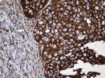 SERBP1 Antibody in Immunohistochemistry (Paraffin) (IHC (P))