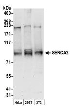 SERCA2 Antibody in Western Blot (WB)