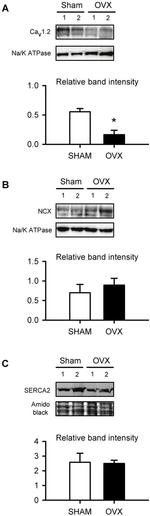 SERCA2 ATPase Antibody in Western Blot (WB)