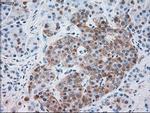 SERPINA1 Antibody in Immunohistochemistry (Paraffin) (IHC (P))