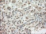 SERPINA1 Antibody in Immunohistochemistry (Paraffin) (IHC (P))