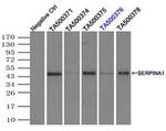 SERPINA1 Antibody in Immunoprecipitation (IP)