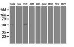 SERPINA1 Antibody in Western Blot (WB)