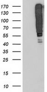 SERPINB13 Antibody in Western Blot (WB)